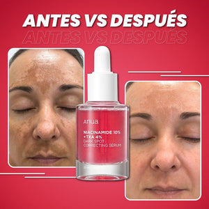 CORRECTOR DE MANCHAS™ -  SERUM